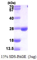 Mouse DHFR Protein (Recombinant His)