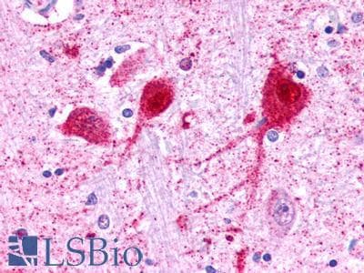 PathPlus™ Polyclonal Rabbit anti-Human GALR3 / Galanin Receptor 3 Antibody (C-Terminus, IHC)