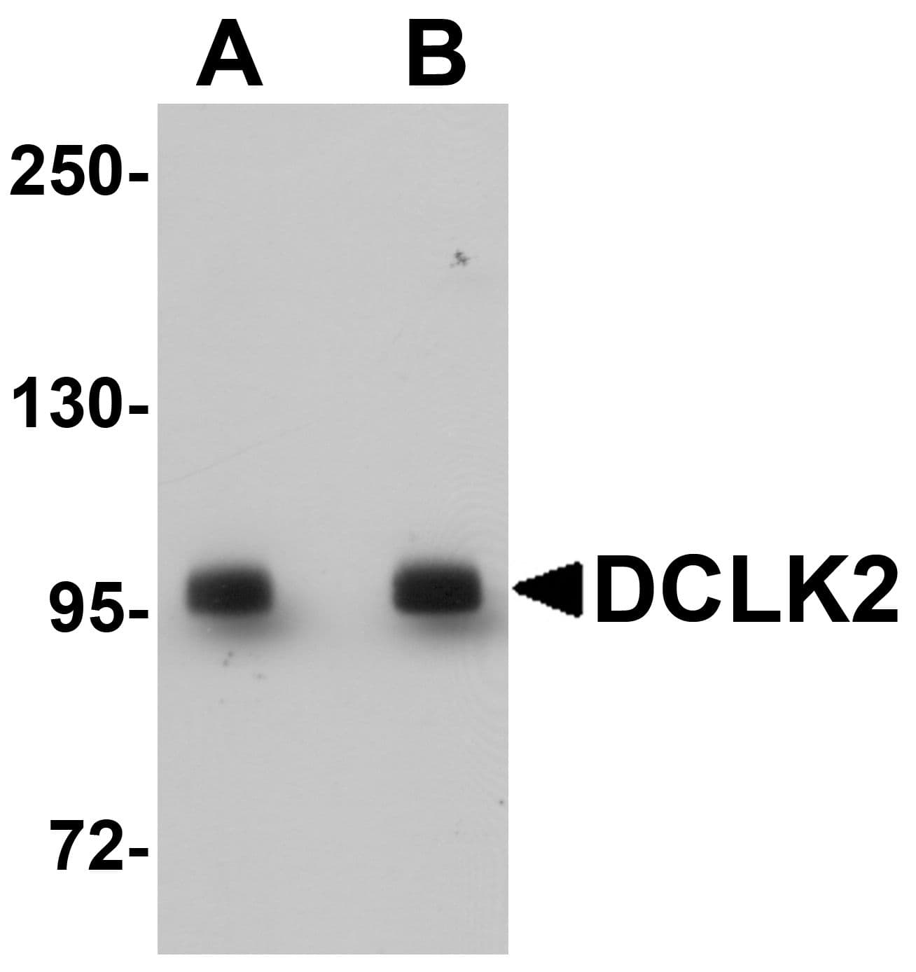 IHC-plus™ DCLK2 / DCAMKL2 Antibody