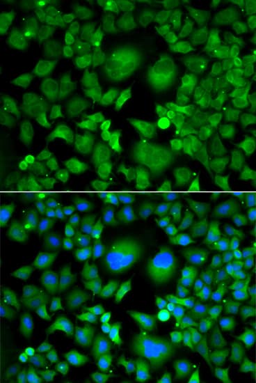 UBCH / UBE2H Antibody
