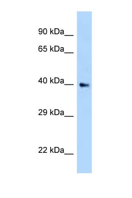 AIDA Antibody (N-Terminus)