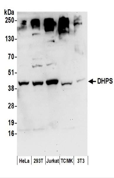 DHPS Antibody (aa319-369)