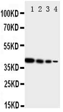 ERBB4 / HER4 Antibody (aa35-51)