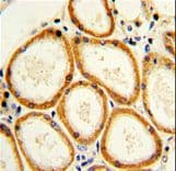CASP2 / Caspase 2 Antibody (aa198-226)