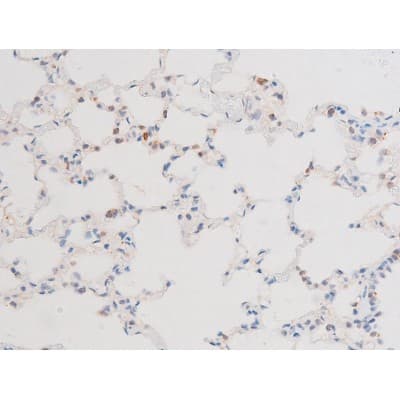 Polyclonal Rabbit anti-Human DNM1 / Dynamin Antibody (phospho-Ser774, IHC, WB)
