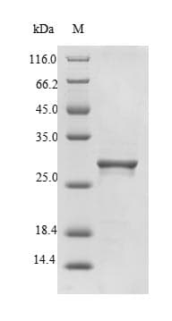 Calloselasma rhodostoma SLYA Protein (Recombinant 6His-SUMO, N-terminus)