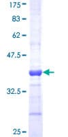 Human SOD3 Protein (Recombinant GST, N-terminus)