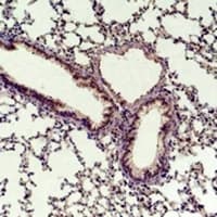 CCND1 / Cyclin D1 Antibody