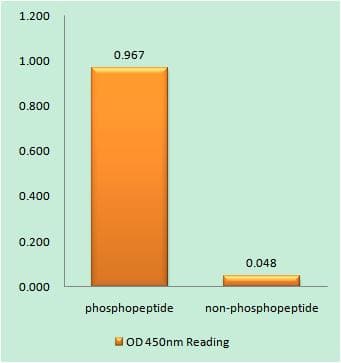 Polyclonal Rabbit anti-Human NCF1 / p47phox / p47 phox Antibody (phospho-Ser328, IHC)