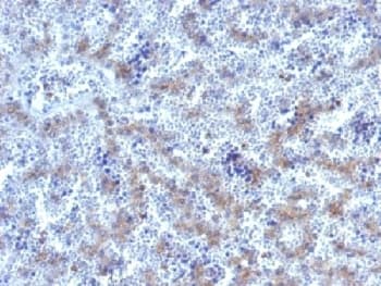 GPC3 / Glypican 3 Antibody