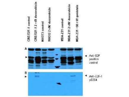 IHC-plus™ E2F1 Antibody (phospho-Ser364)