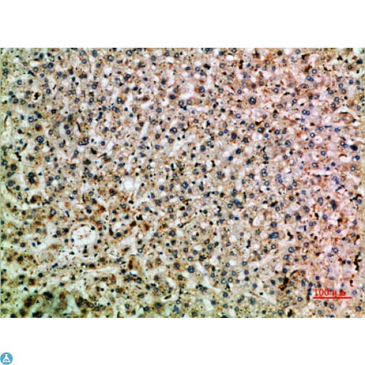Polyclonal Rabbit anti-Human TNIP2 / ABIN-2 Antibody (IHC)