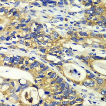 Polyclonal Rabbit anti-Human RPH3A / Rabphilin 3A Antibody (IHC, WB)