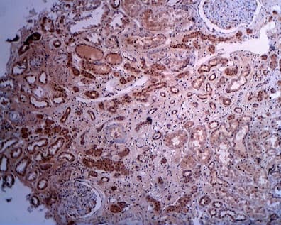 Polyclonal Rabbit anti-Human SGMS1 / TMEM23 Antibody (IHC, WB)