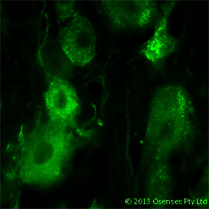 NGFR / CD271 / TNR16 Antibody (clone MC192)
