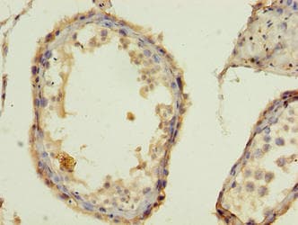 Polyclonal Rabbit anti-Human BARX1 Antibody (WB)