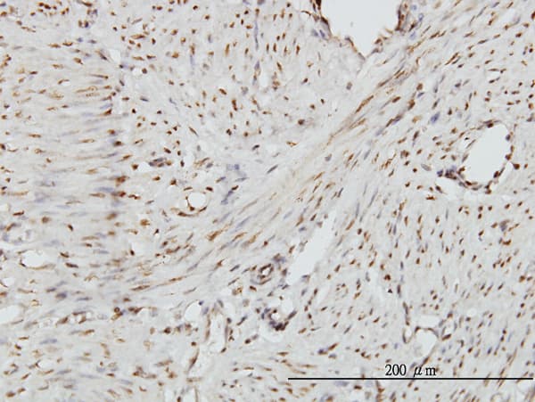 ZHX2 / RAF Antibody (clone 5E2)