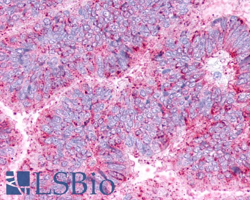 PathPlus™ Polyclonal Rabbit anti-Human CRHR2 / CRF2 Receptor Antibody (Extracellular Domain, IHC)