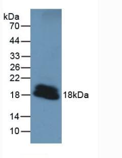 Mouse PTHLH / PTHRP Protein (Recombinant His, N-Terminal)