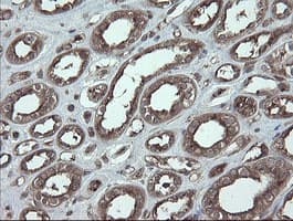 Monoclonal Mouse anti-Human UBE2J1 Antibody (clone OTI3C11, IHC, WB)