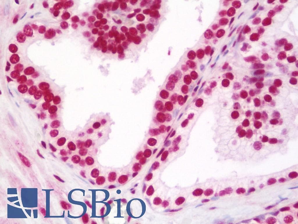 IHC-plus™ Polyclonal Rabbit anti-Human NFYC Antibody (aa408-458, IHC)
