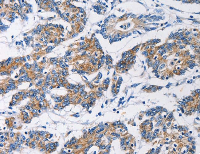 HK1 / Hexokinase 1 Antibody