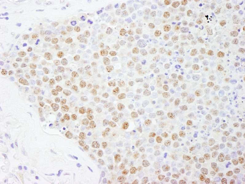 Polyclonal Rabbit anti-Human FOXK2 / ILF Antibody (aa635-660, IHC, WB)