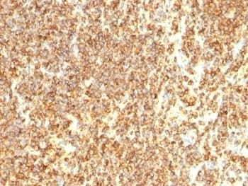 Monoclonal Mouse anti-Human CD20 Antibody (clone SPM494, IHC, IF)