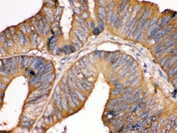 TF / Transferrin Antibody