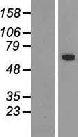 TBX18 Protein (Over-Expression Lysate Myc-DDK (Flag))