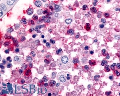 PathPlus™ CCR1 Antibody (Extracellular Domain)