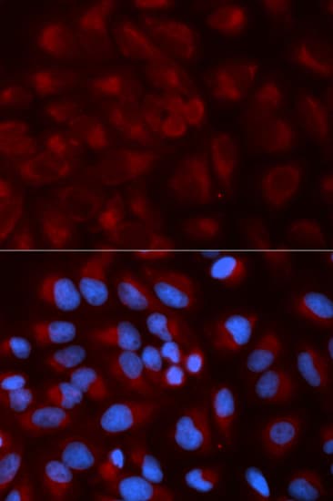 NDUFS1 Antibody