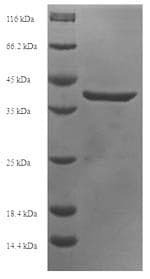 Human APOBEC3A Protein (Recombinant 6His-SUMO, N-terminus)