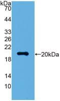 VILIP / VSNL1 Antibody (aa39-184)