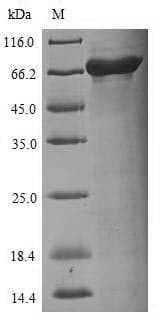 Hepatitis B Virus Nucleocapsid Protein (Recombinant 6His-SUMO, N-terminus)