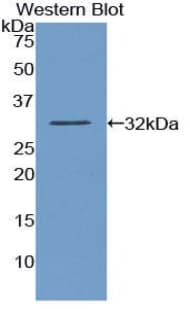 AMY2A / Pancreatic Amylase Antibody (aa188-432, PE)