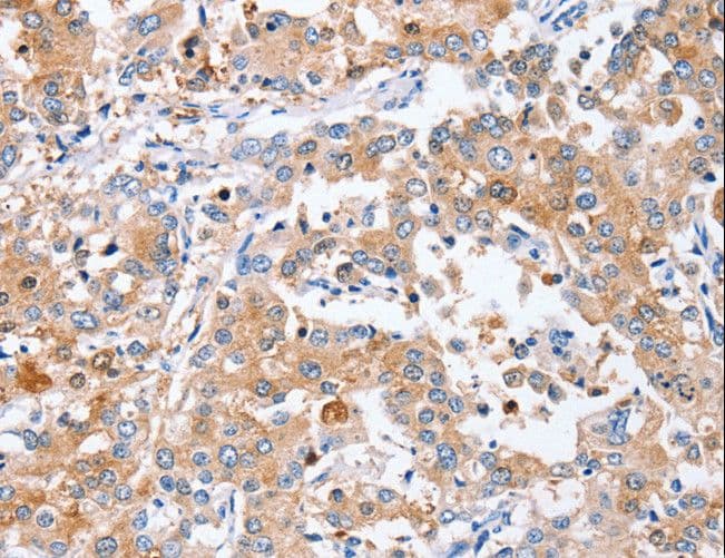 Polyclonal Rabbit anti-Human PPOX Antibody (IHC)