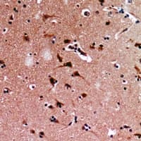 GFM1 Antibody