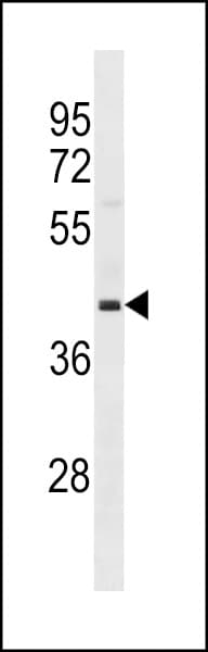 OPCML / OBCAM Antibody (aa172-200)