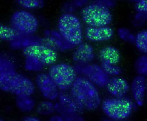 Polyclonal Rabbit anti-Human HDAC1 Antibody (aa425-C-term, IHC, IF)