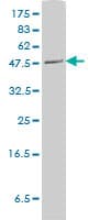 Monoclonal Mouse anti-Human PLTP Antibody (clone 2F3-G4, WB)