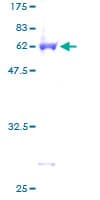 Human LASP1 Protein (Recombinant GST)