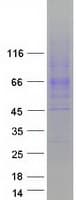 Human SLC6A4 / SERT Protein (Recombinant Myc-DDK (Flag))