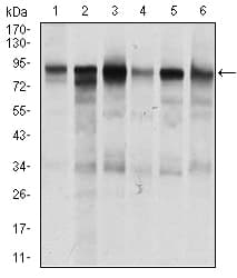 Betaglycan / TGFBR3 Antibody (aa147-328, clone 1C5H11)