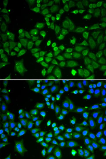 ECI1 / DCI Antibody