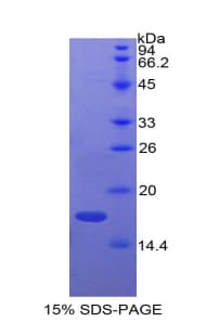 Bovine ADM / Adrenomedullin Protein (Recombinant His)