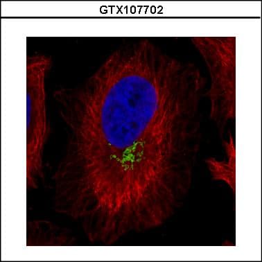 GOLM1 / GP73 / GOLPH2 Antibody (aa339-401)