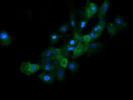 RAB21 Antibody (clone OTI6F11)