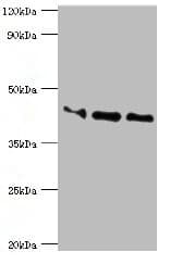 APOL1 / Apolipoprotein L Antibody (aa179-398)