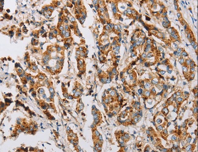 Fragilis / IFITM3 Antibody